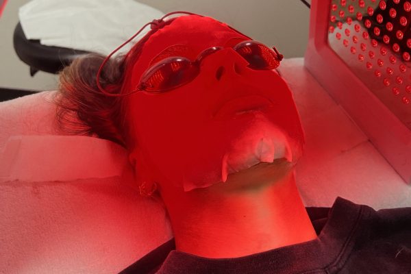 facial threading and microneedling elk grove ca 95758