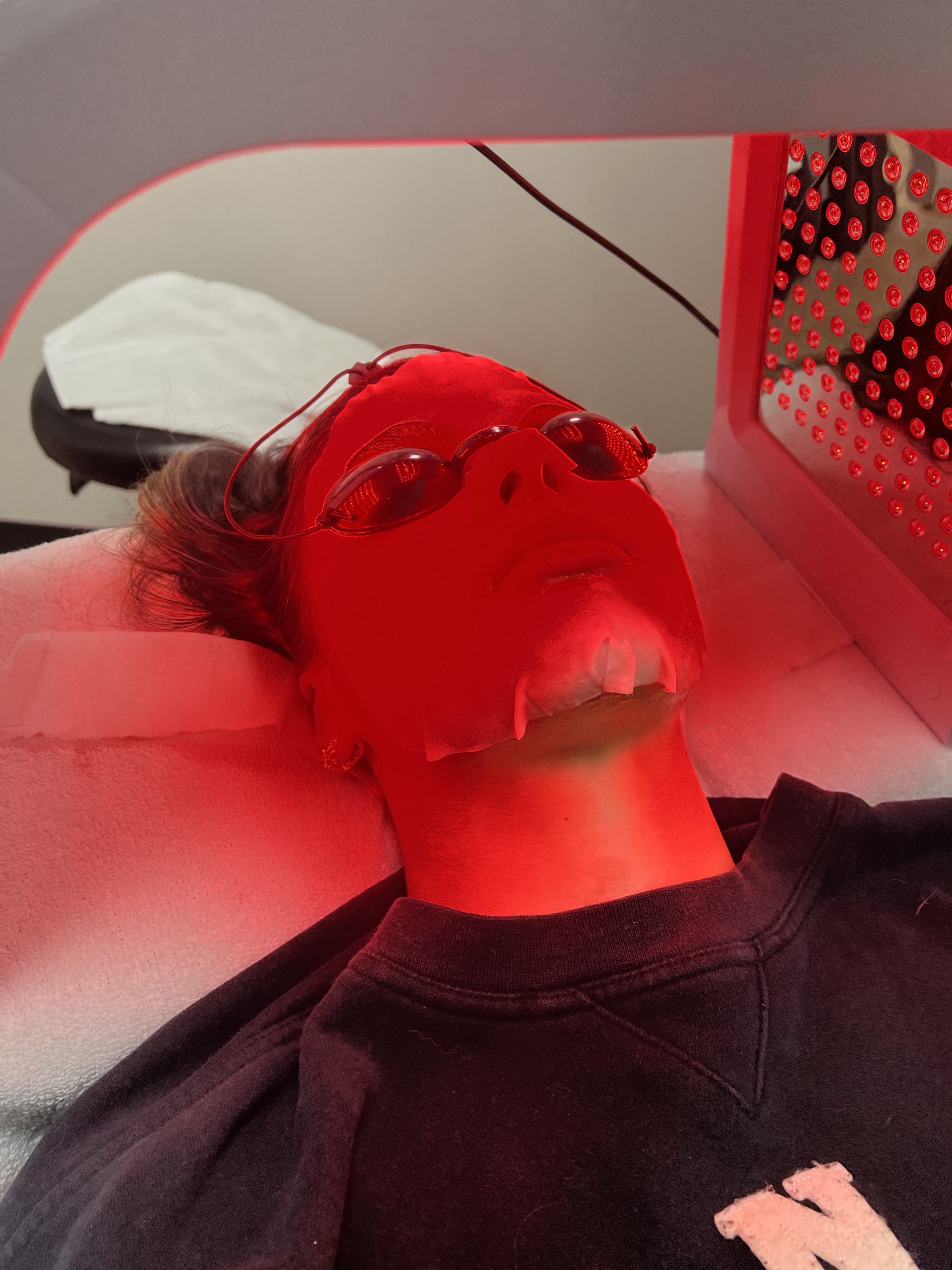 facial threading and microneedling elk grove ca 95758