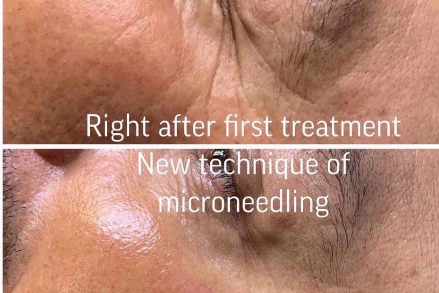   Discover the Best Eyebrow Threading in Elk Grove, CA